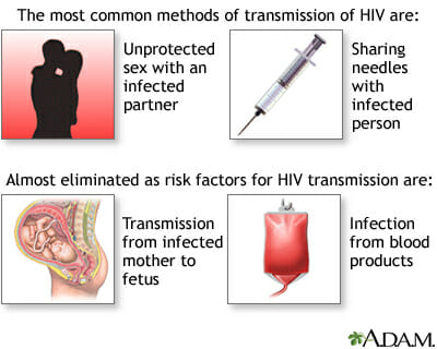 STD Testing Elk Grove, CA 